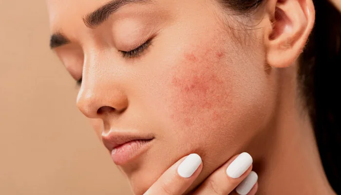 Treating Skin Problems 